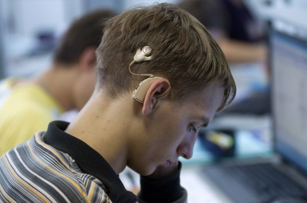 НИИ уха, горла, носа и речи поменяет процессоры на слуховых аппаратах пациентов