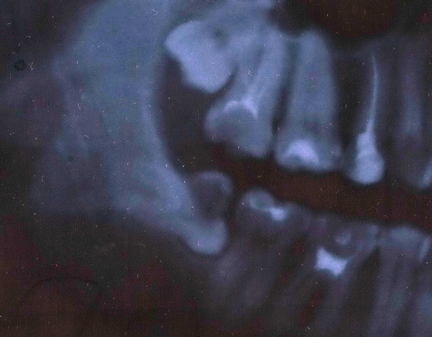 В частной стоматологической клинике петербурженка лишилась 22 здоровых зубов